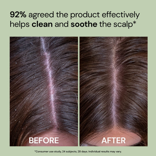 Happy Roots Post-Cleanse Soothing Reset