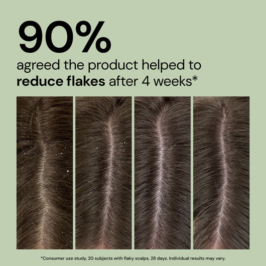 Happy Roots Post-Cleanse Soothing Reset